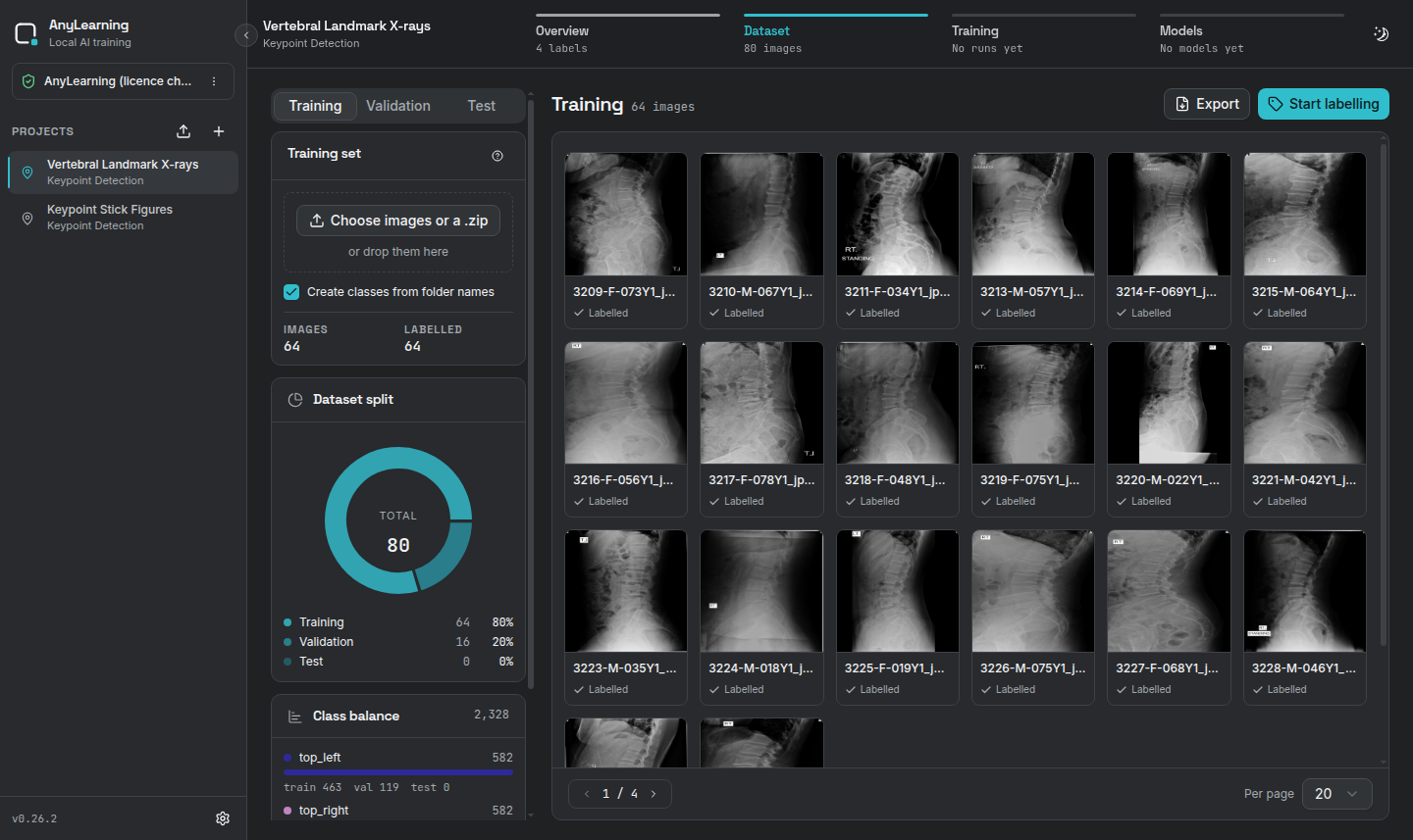 Imported real X-rays in the Dataset screen