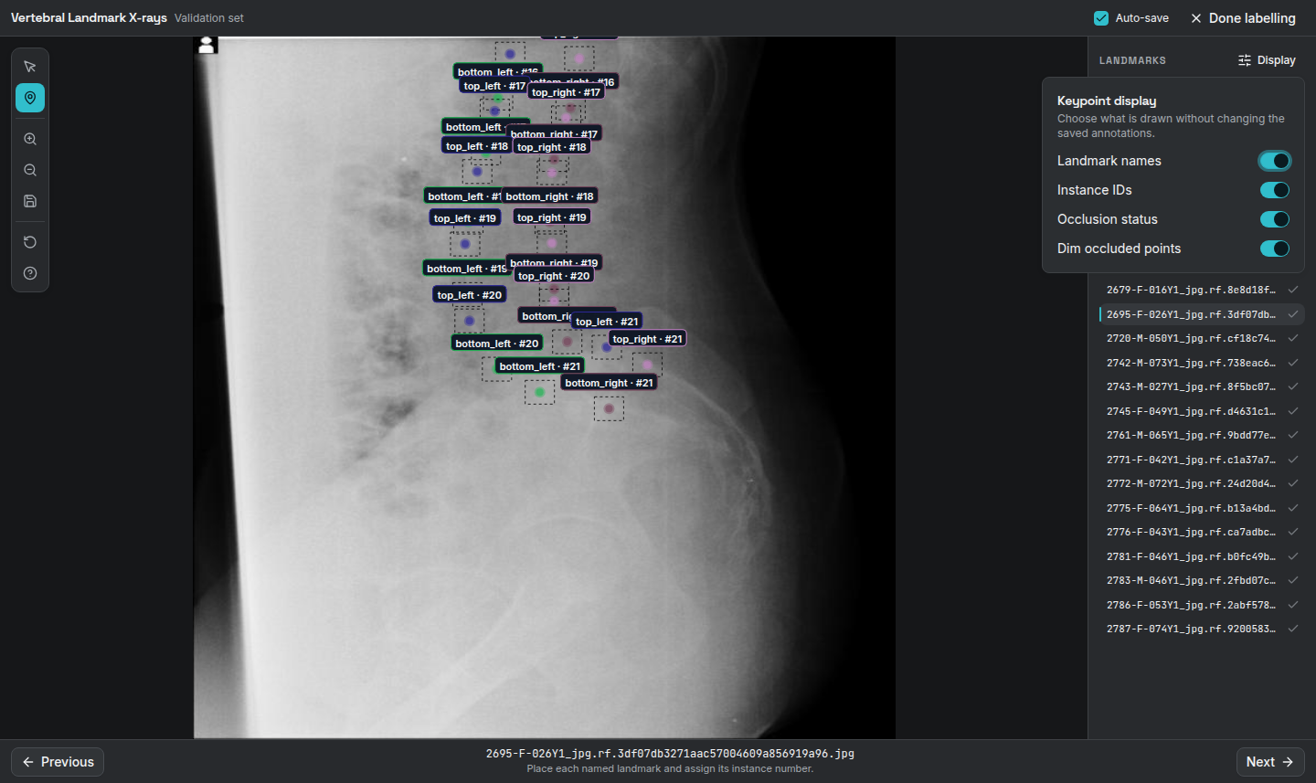 Real vertebral landmark instances in the AnyLearning labeller