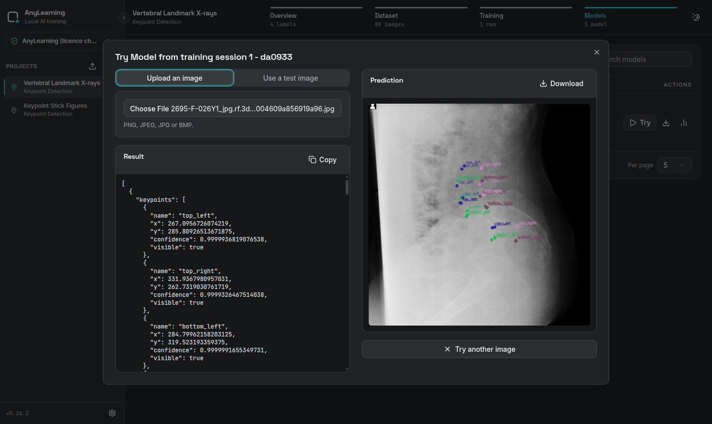 Held-out vertebral X-ray prediction and structured keypoint result